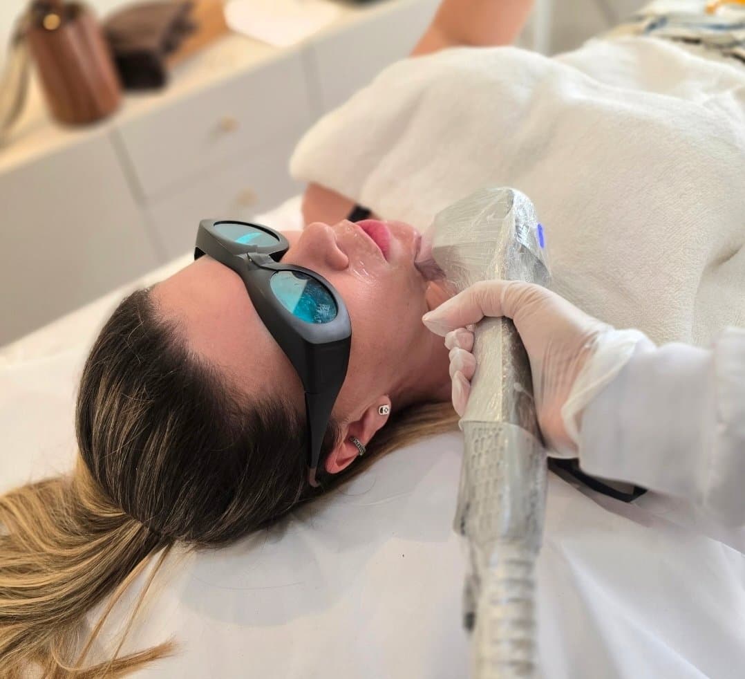 Depilação a laser